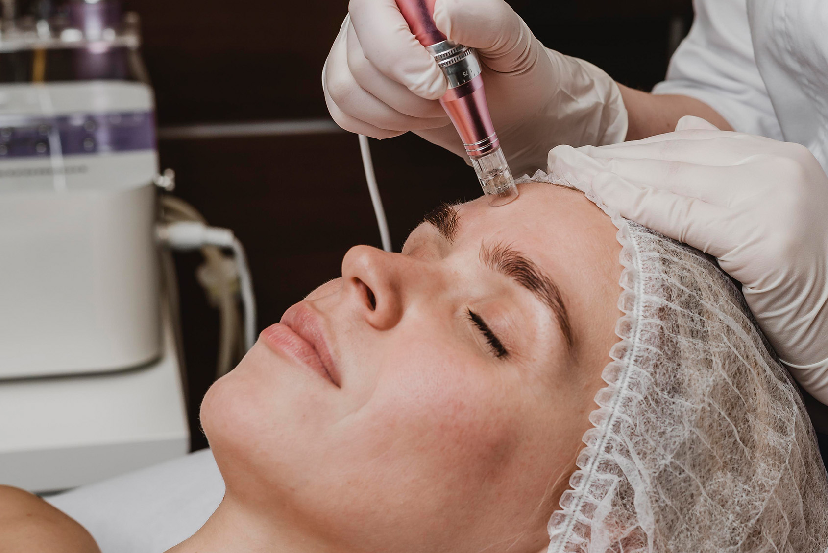 Mezoterapia igłowa we Wrocławiu – kiedy widoczne są efekty?