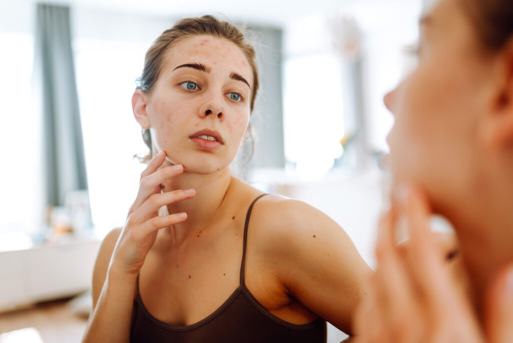 Profilaktyka i wczesna diagnostyka skórna