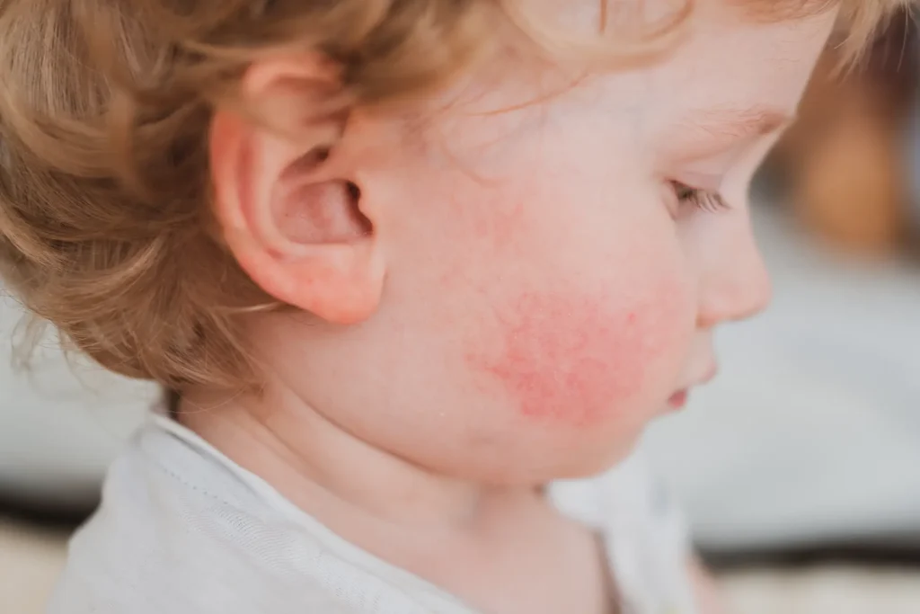 dermatolog dziecięcy wrocław